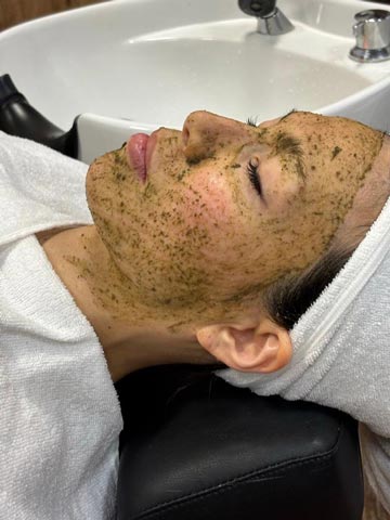 クレーター改善