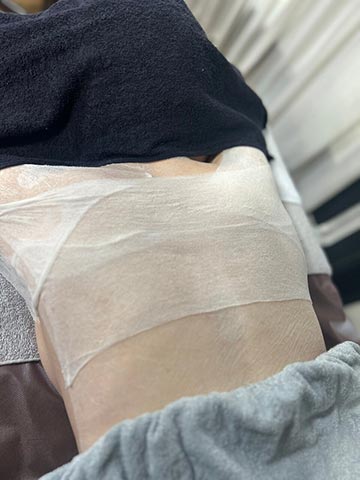 ブライダル美背中コース